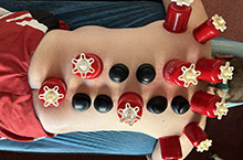 Навчання вакуумної терапії