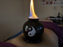 Вісцеральний масаж живота