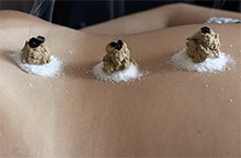 обучение моксотерапии и акупунктуры